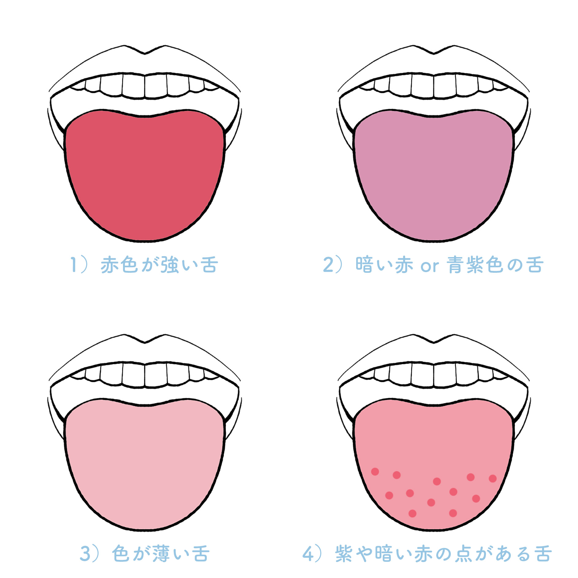 舌診って？】舌を確認する「舌診」で、健康状態を簡単にチェック